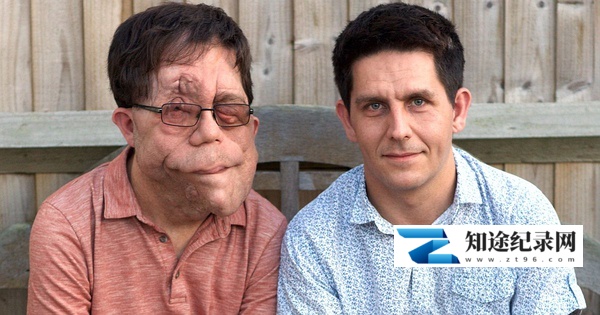 [BBC]我的神奇双胞胎 My Amazing Twin-知途纪录片网盘资源下载