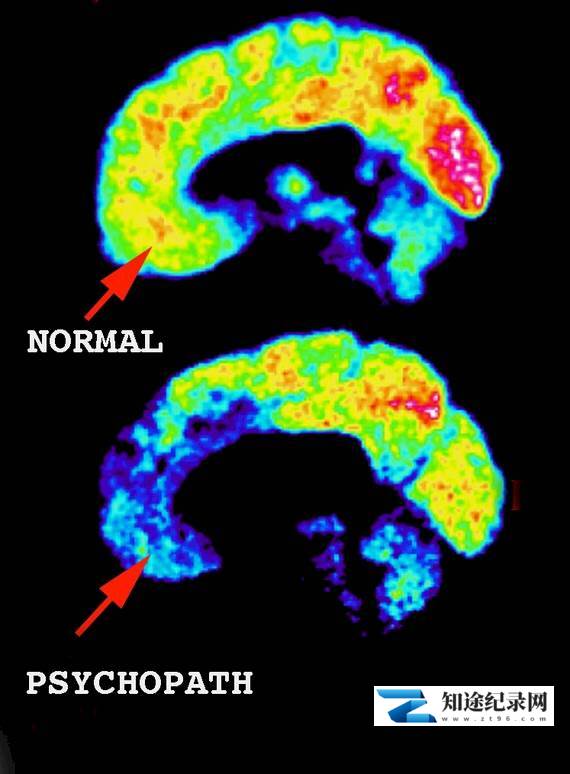[BBC]精神变态病因调查 What Makes A Psychopath?-知途纪录片网盘资源下载